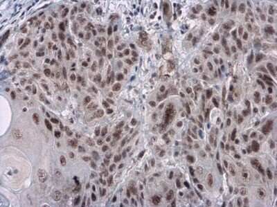 Immunohistochemistry-Paraffin: Rad17 [p Ser656] Antibody [NBP3-13072]